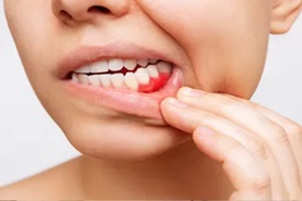 Gum Treatments